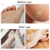 Foot File Scraper Rasp Hard Dead Dry Skin Remover Grater Callus Pedicure Black